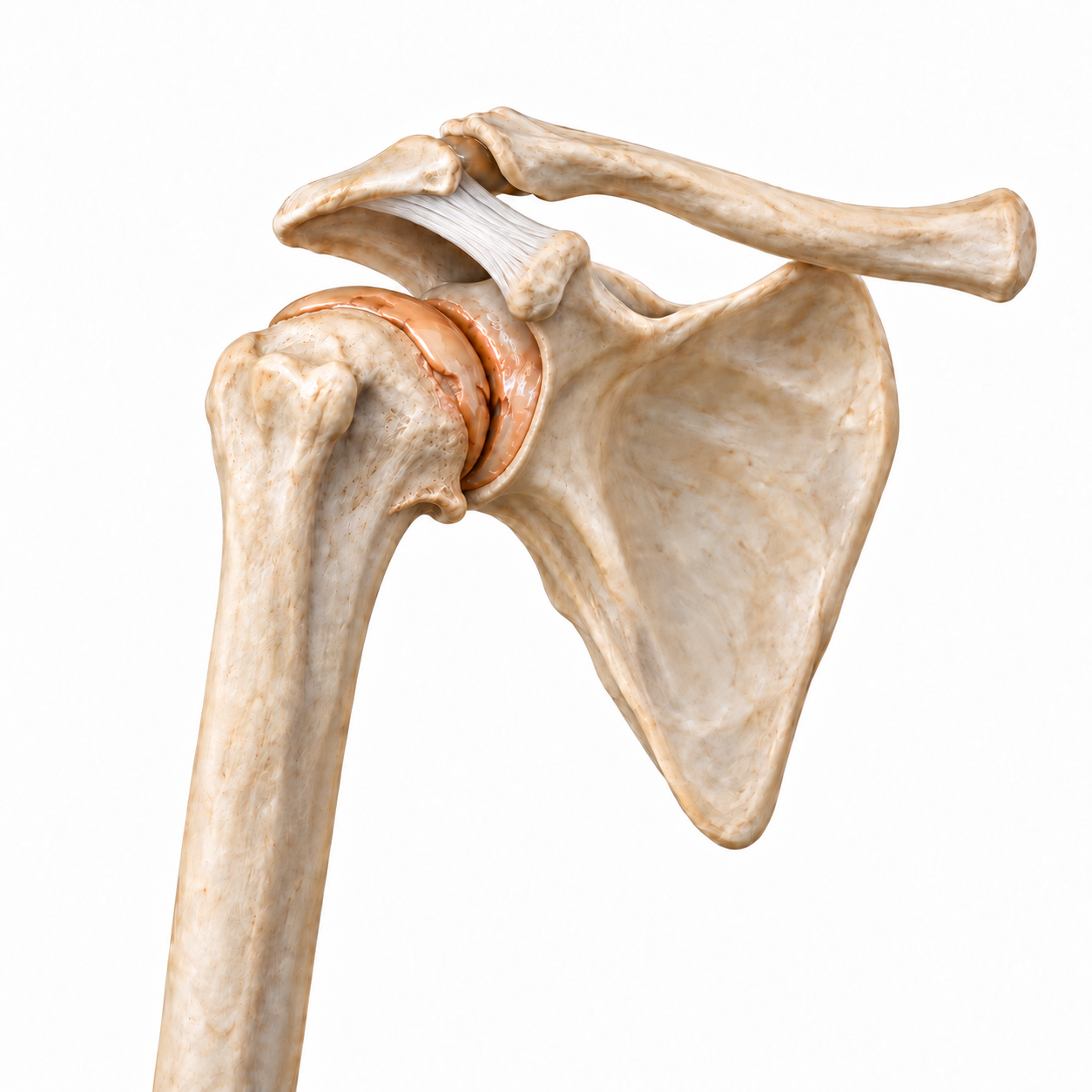 Illustration einer Arthrose des Schultergelenks